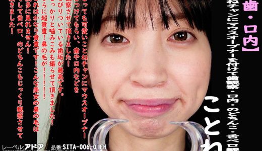 【HD】【歯・口内】大人気美女ことねチャンのマウスオープナーを付けて歯観察・口内・のどちんこ・舌ベロ観察!ことね